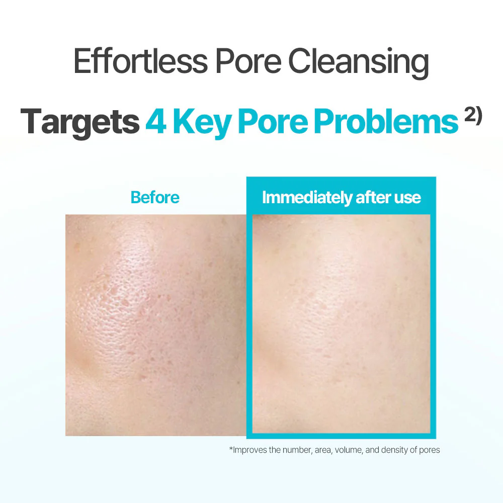 Aperire Be Frozen Pore Mask – Instant Cooling & Pore Tightening Glacial Clay Pack - Image 5