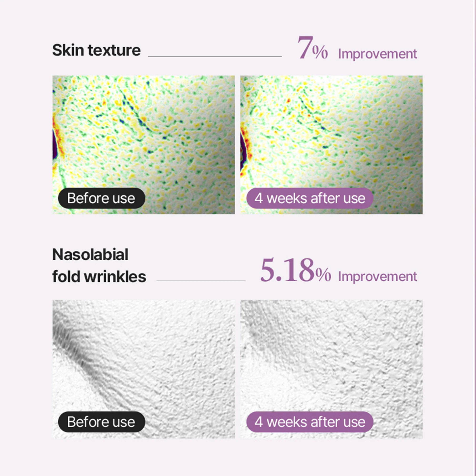 Arocell Super Shot Coltra Ampoule – Korean Collagen Spicule Ampoule for Deep Absorption - Image 5