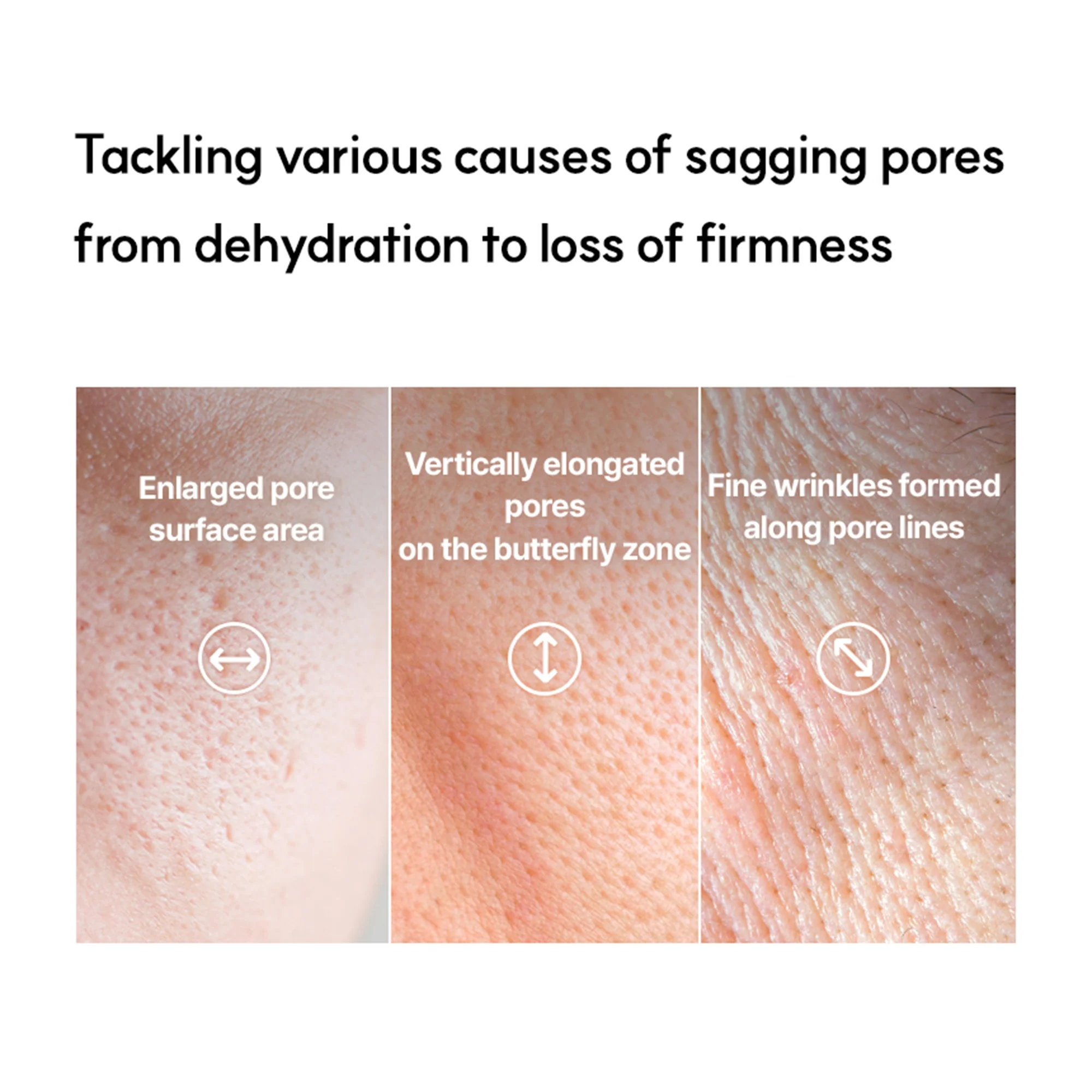 Arocell Botulcare Pore Lifting Ampoule – Pore Tightening & Wrinkle Lifting Serum for Sagging Pores & Fine Line - Image 6