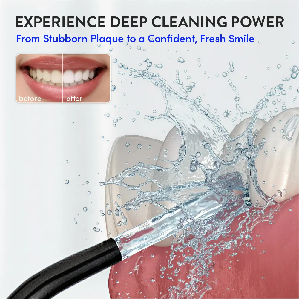 éclat Complete Oral Care Bundle: Cordless Water Flosser + Steel Tongue Scraper Kit - Image 71