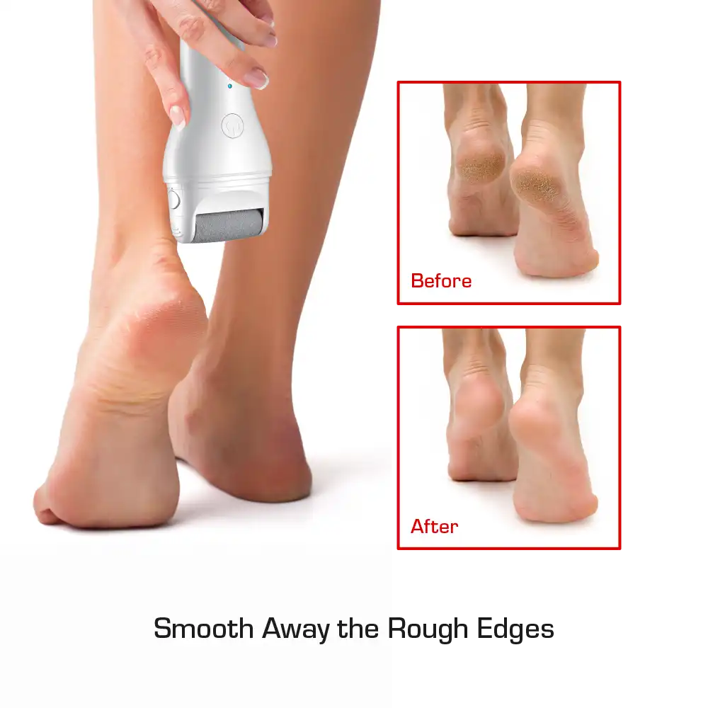 RED by KISS Cordless Electric Foot File Callus Remover - Image 2