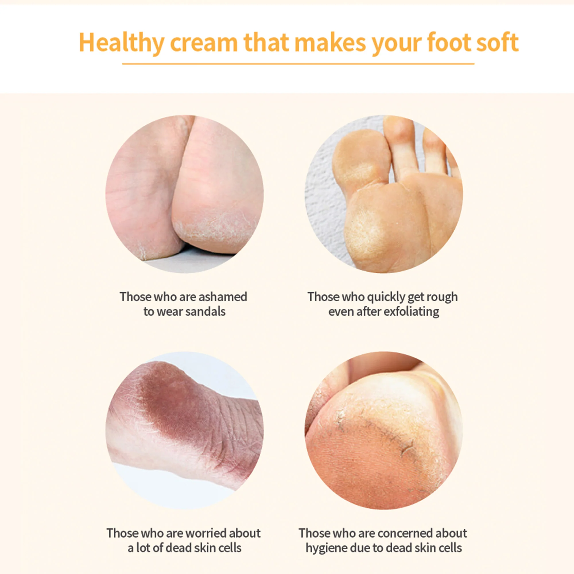 3WB Luxury Foot Cream – Intensive Urea & Propolis Repair for Cracked Heels, Dry Calluses, and Peeling Skin - Image 6