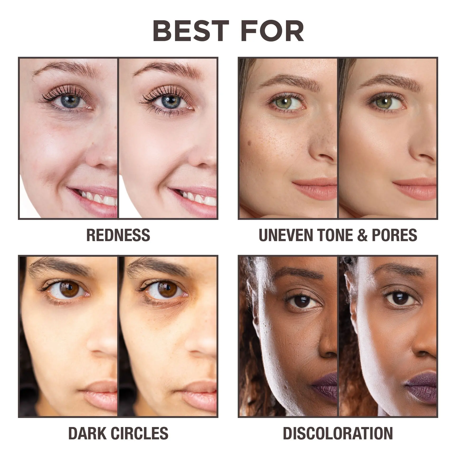 Ivy Beauty Full Coverage Under Eye Concealer for Dark Circles, Redness & Blemishes - Image 137
