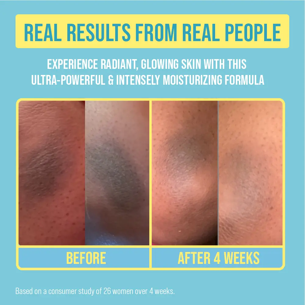 RED by KISS Glow Up Brightening Body Cream – Kojic Acid, Vitamin C & Niacinamide - Image 4