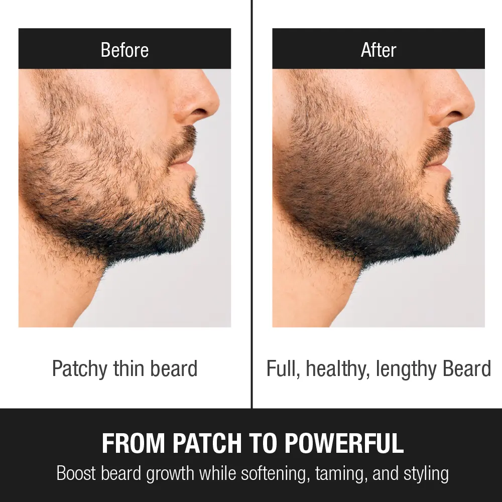 RED by KISS Groomane Beard Oil for Growth – Biotin & Argan Infused - Image 10
