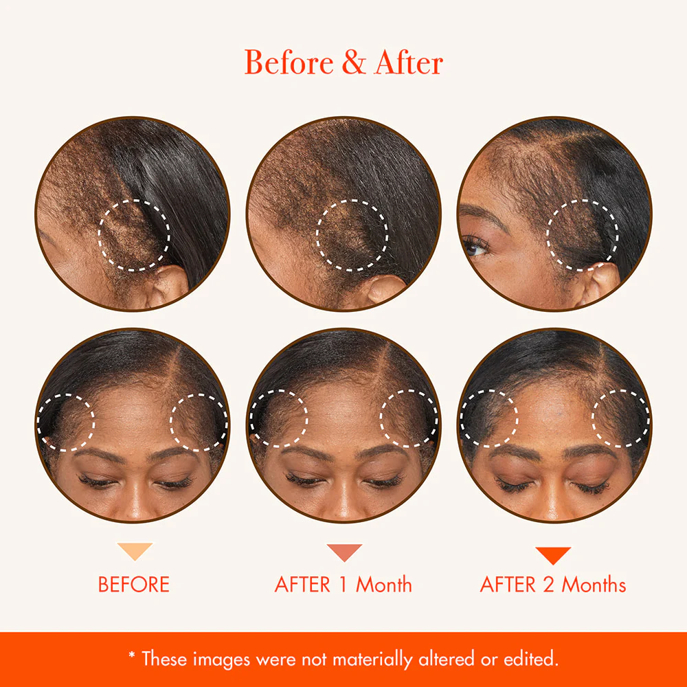RED by KISS Growth MD Scalp Ampoule - Image 6