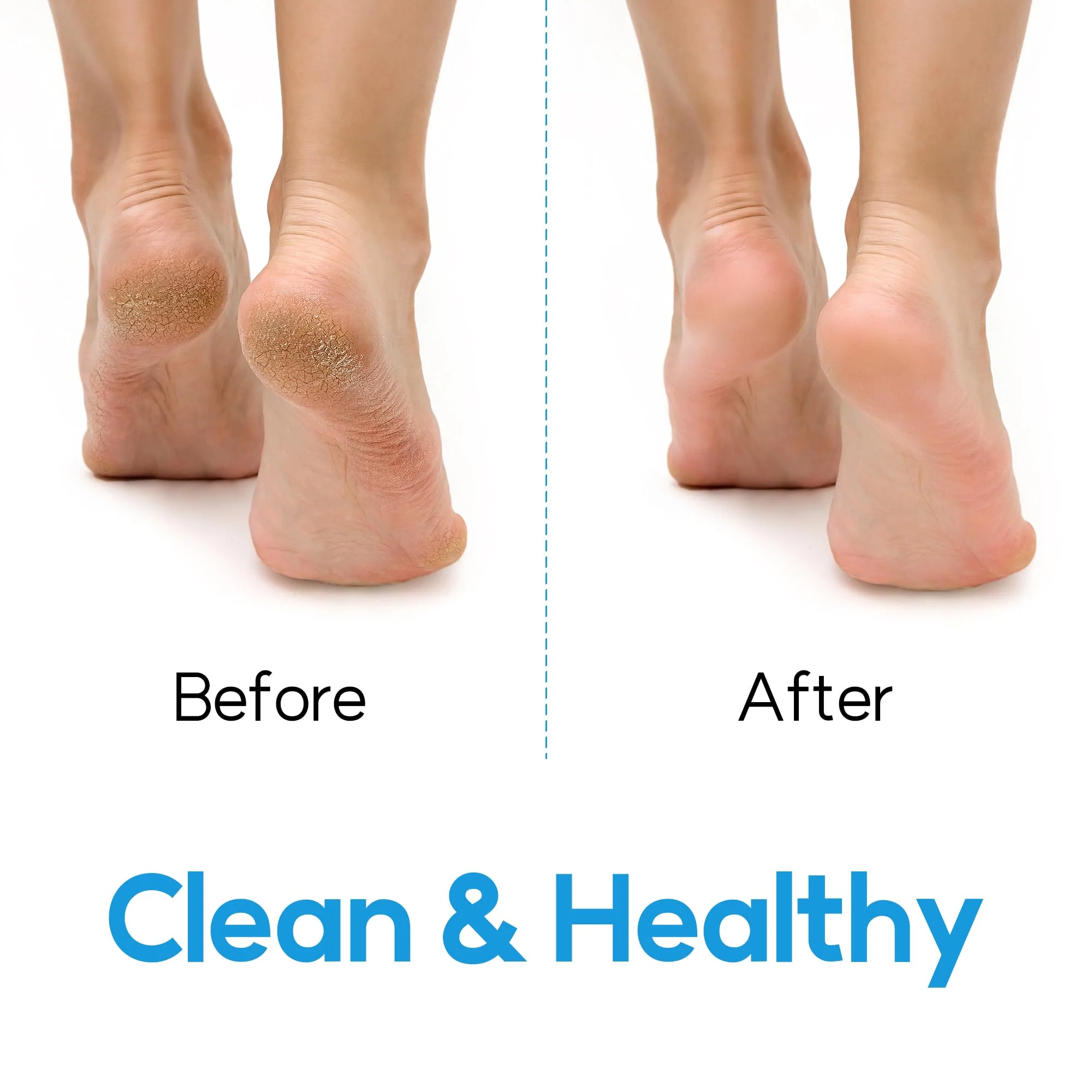 Ballon Hands-Free Foot Scrubber & Massager For Shower - Non-Slip, Ideal for Back Pain & Pregnancy - Image 5