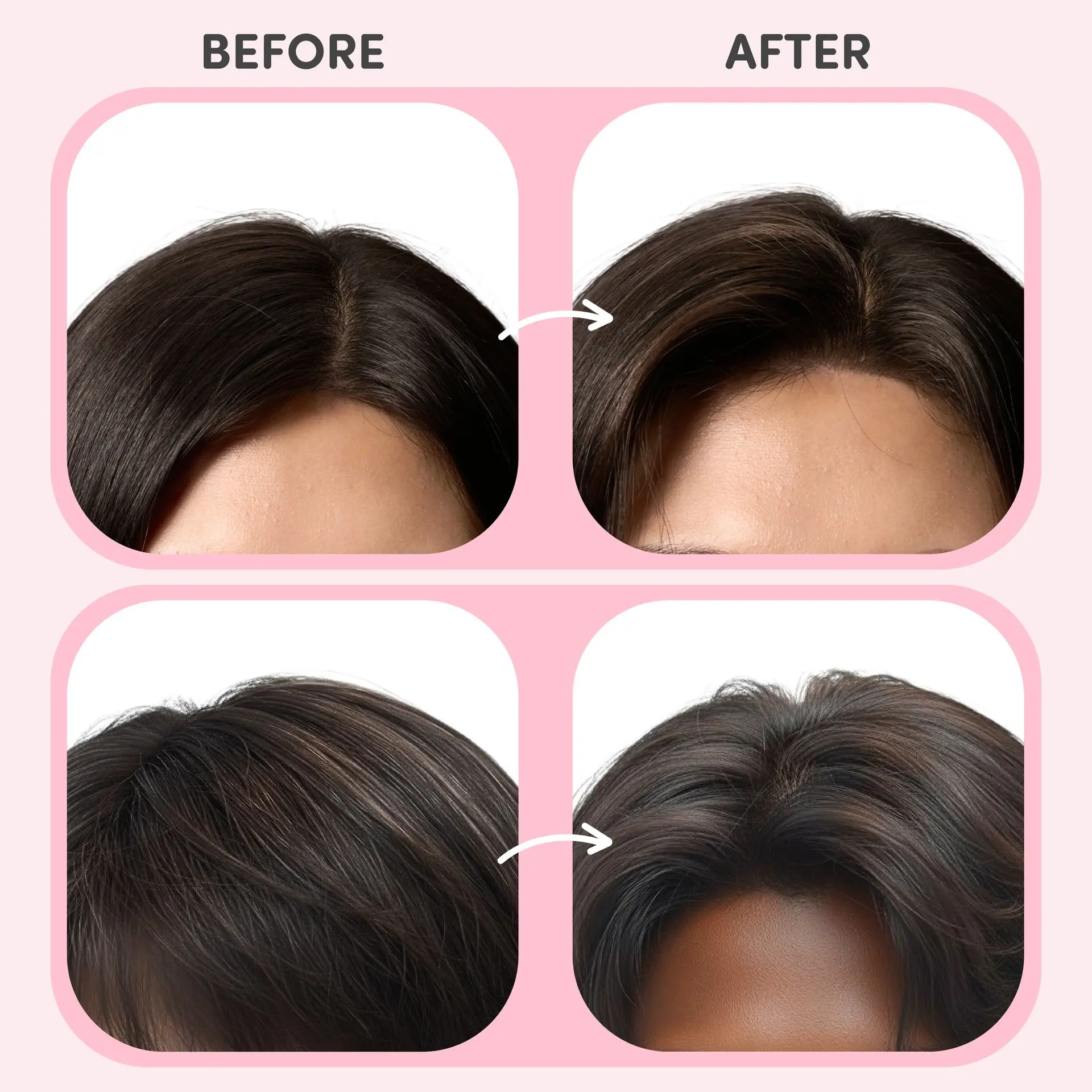 éclat Heatless Volumizing Hair Root Booster Clips - 2pcs Set - Image 2