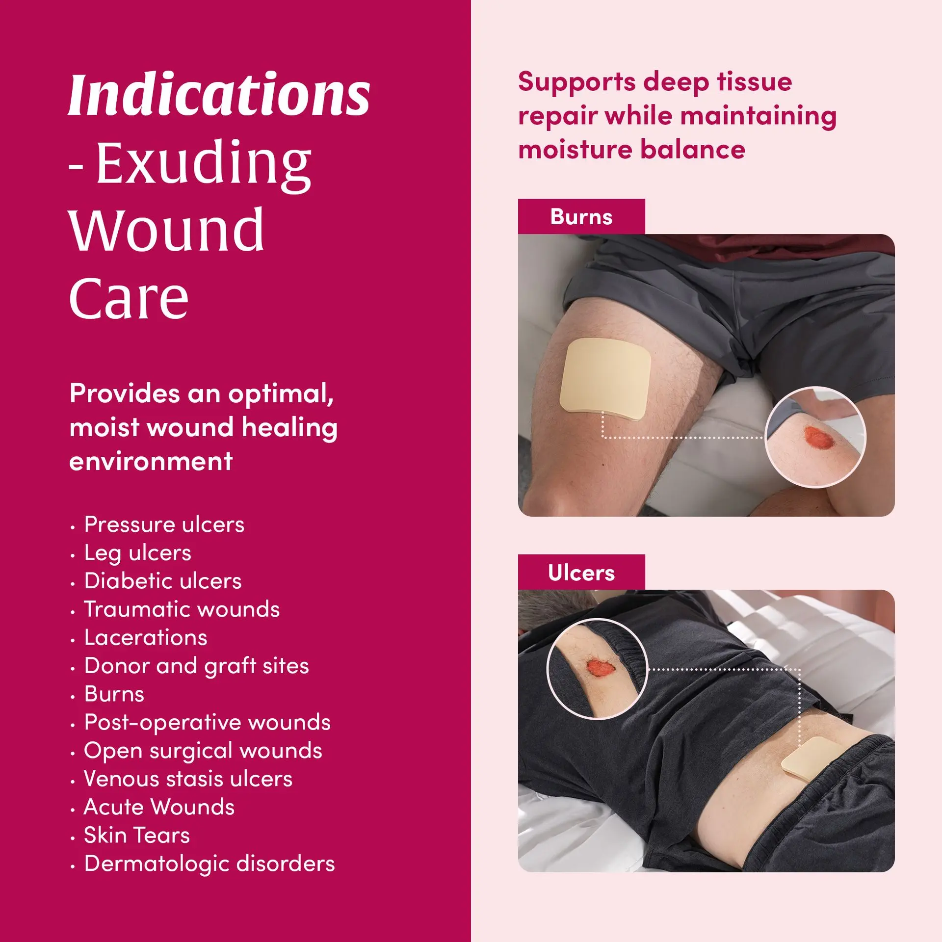 Medifoam Non-Adhesive Hydrocolloid Wound Dressing Pad - 10 Sheets(4" × 4") - Image 3