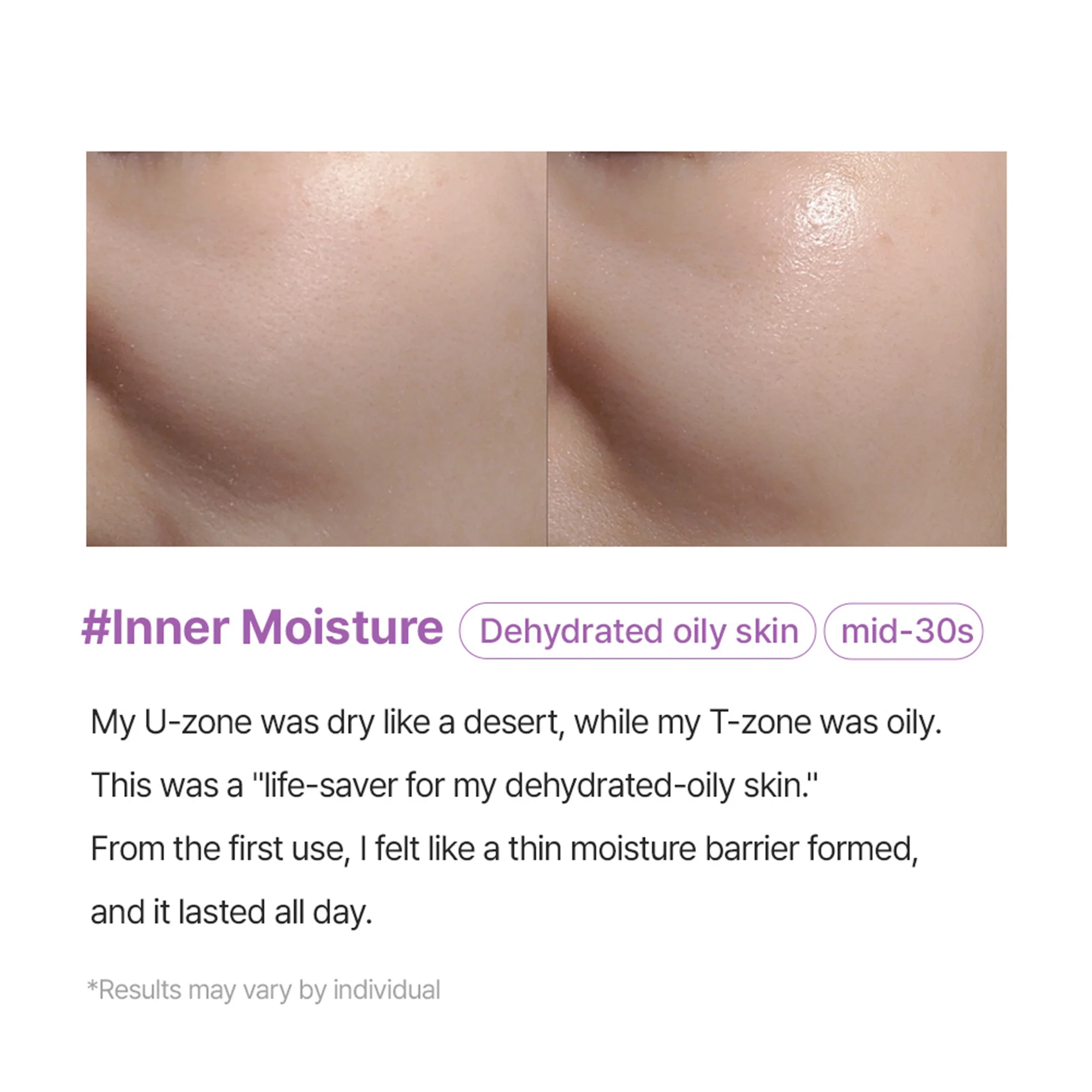 Arocell Super Collagen Booster Bubble Serum – Visible Firmness & Glow in 2 Weeks - Image 4