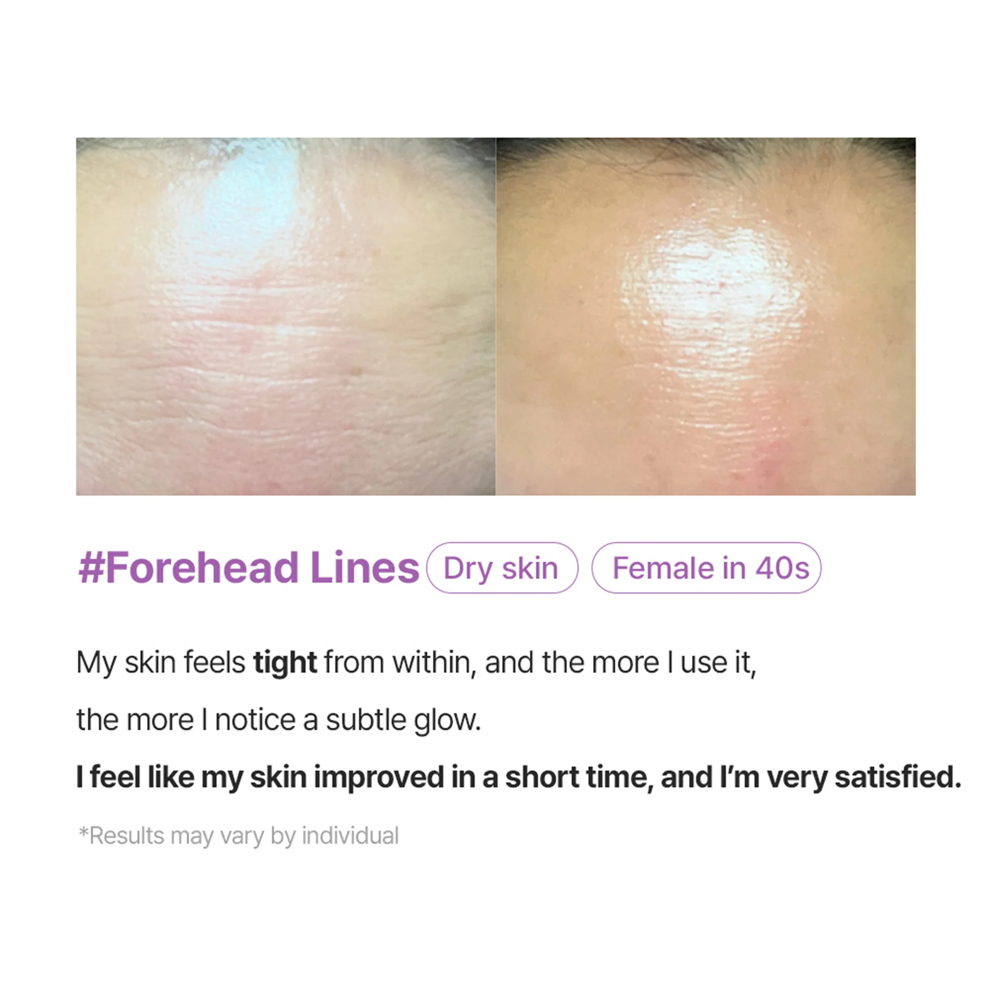 Arocell Super Collagen Booster Bubble Serum – Visible Firmness & Glow in 2 Weeks - Image 5