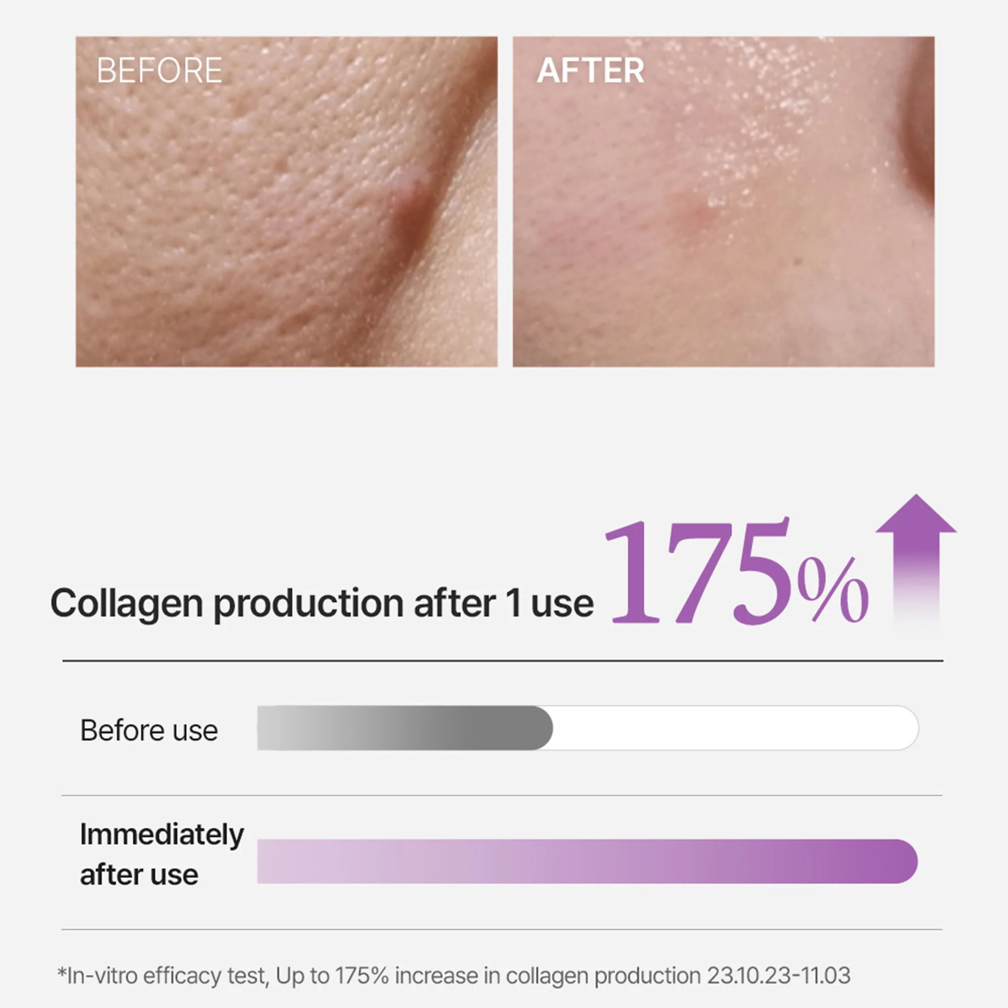 Arocell Super Collagen Booster Bubble Serum – Visible Firmness & Glow in 2 Weeks - Image 7