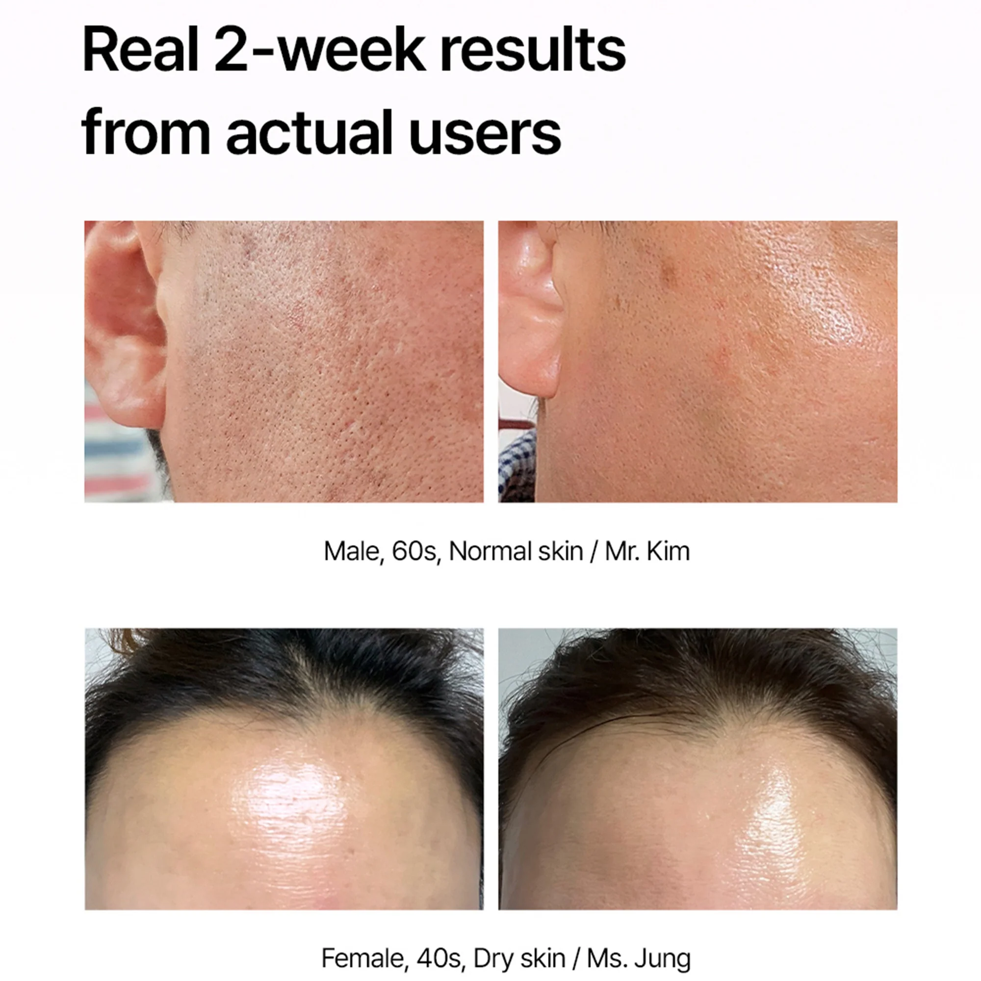 Arocell Super Collagen Booster Bubble Serum – Visible Firmness & Glow in 2 Weeks - Image 8