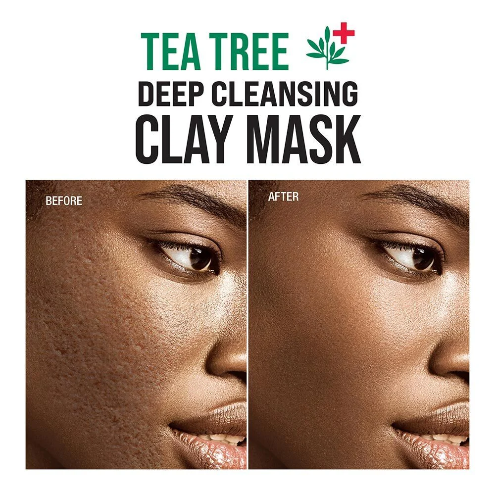 Kiss New York Tea Tree Deep Cleansing Clay Mask - Image 4