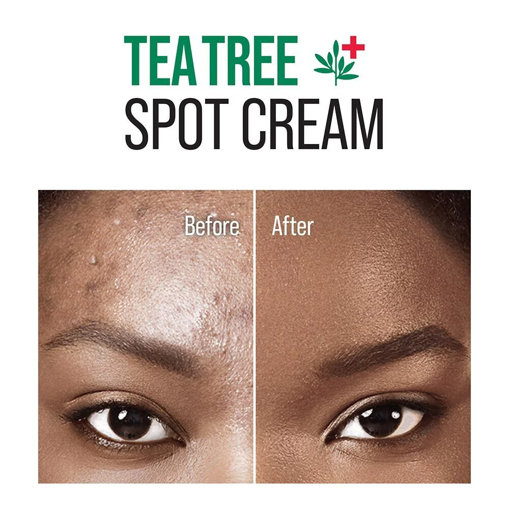 Kiss New York Tea Tree Spot Cream - Image 5