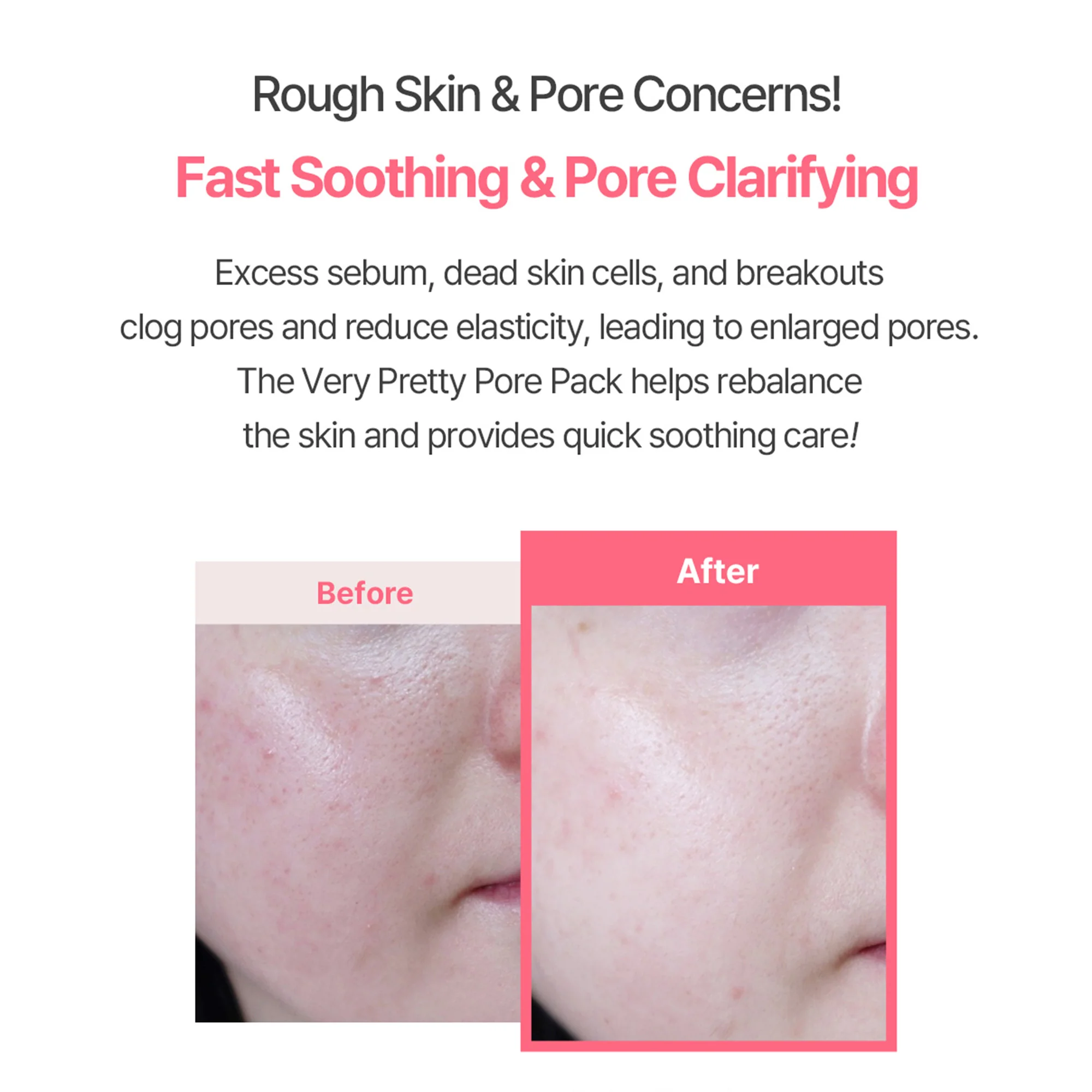 Aperire Very Pretty Pore Mask – Pore Tightening Pink Clay Mask with Calamine & Centella for Blackheads - Image 2